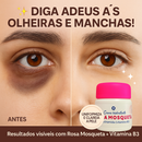 Creme Rosa Mosqueta com Niacinamida Clareador de Olheiras e Manchas Visíveis na Pele