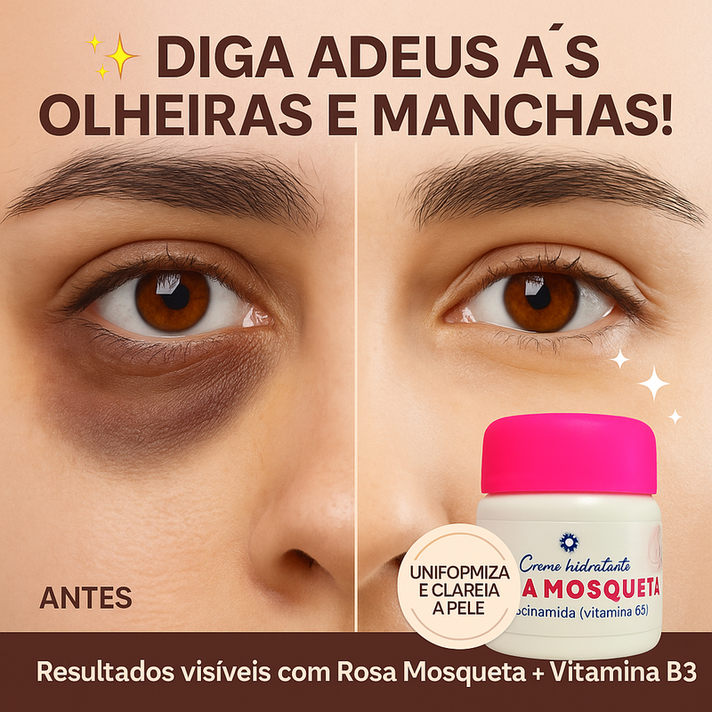 Creme Rosa Mosqueta com Niacinamida Clareador de Olheiras e Manchas Visíveis na Pele